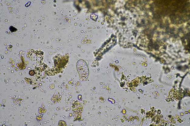 Как вылечить Escherichia coli в моче: методы лечения и профилактика